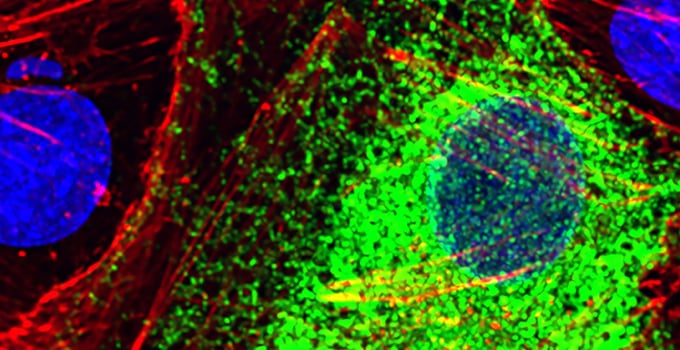 La herramienta de Stanford que distingue células sanas de enfermas leyendo qué genes se encienden