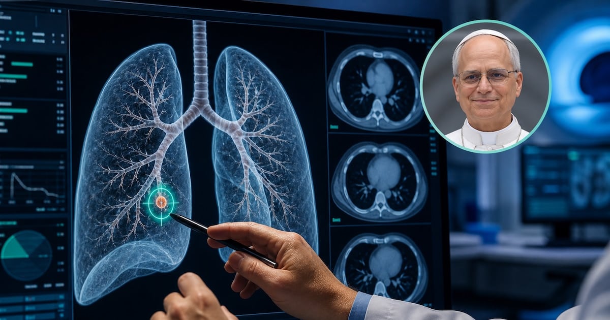 Nódulo pulmonar: por qué los médicos suelen optar por sacarlo incluso cuando mide apenas unos milímetros
