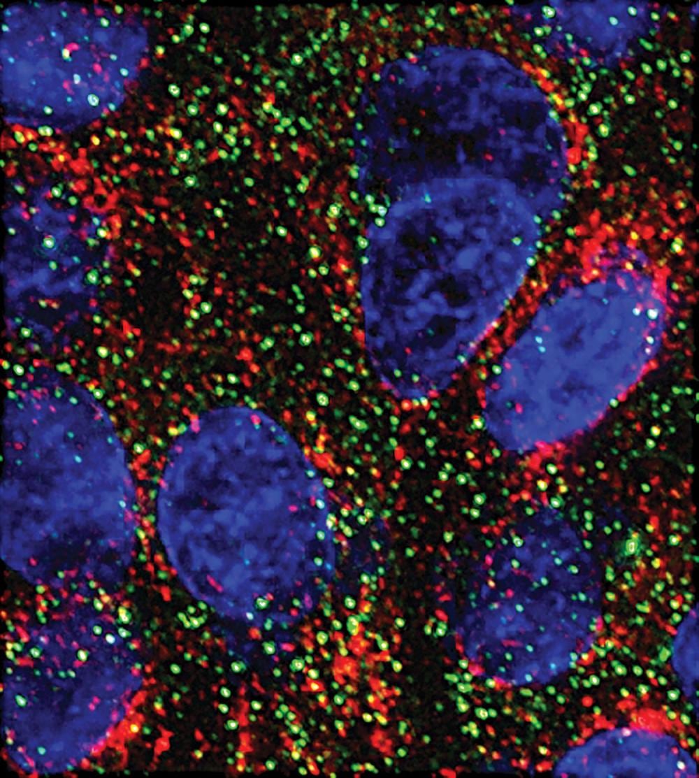 MicroARNhold promising avenue against pancreatic cancer
